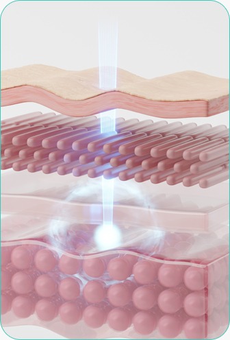left image