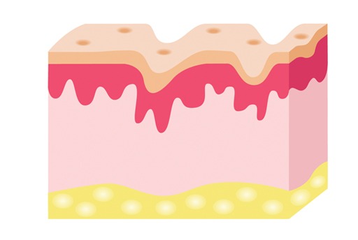 process 1 image