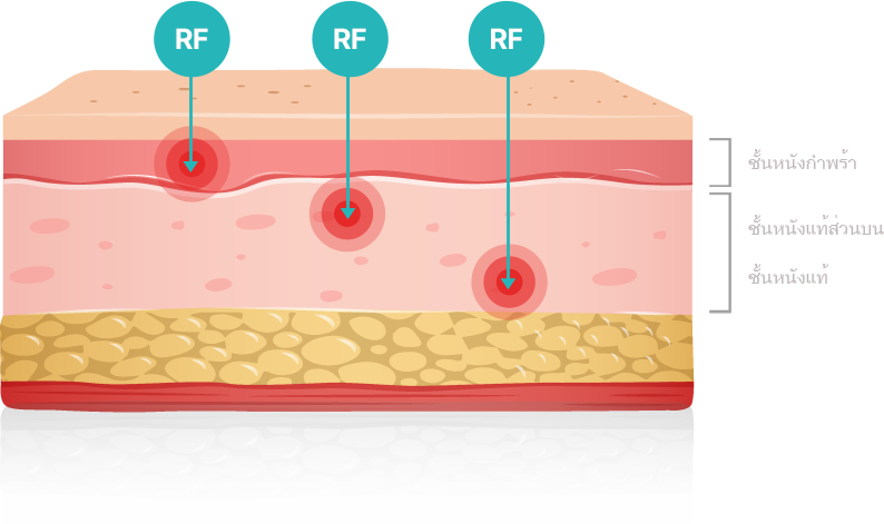 rf image 1