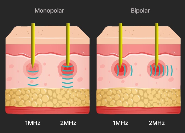 rf image 2